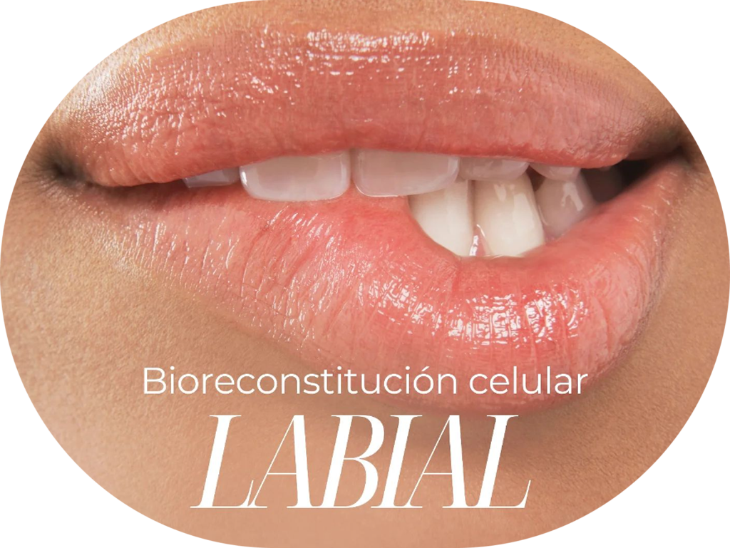 Imagen de labios con bioreconstitucion labial